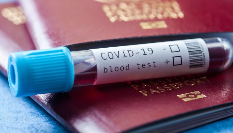 Voyage à l’étranger : les tests PCR sont-ils remboursés ?